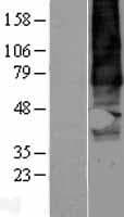 GPR137B Protein (Over-Expression Lysate Myc-DDK (Flag))