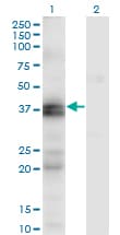 EDNRA / Endothelin A Receptor Antibody (clone 2A5)