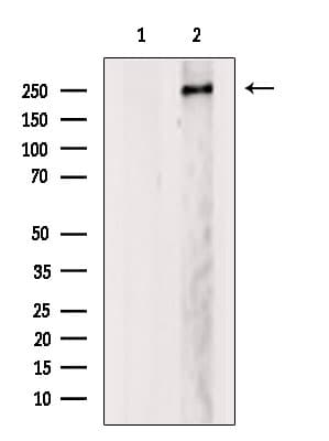 Polyclonal Rabbit anti-Human MED12 Antibody (WB)