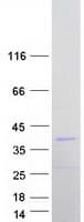 Human MINPP1 Protein (Recombinant Myc-DDK (Flag))