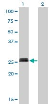Monoclonal Mouse anti-Human MYOG / Myogenin Antibody (clone 2B7, WB)