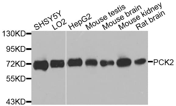 Polyclonal Rabbit anti-Human PCK2 / PEPCK Antibody (WB)