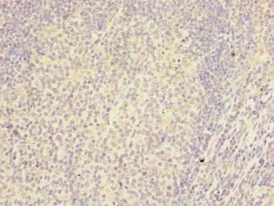 Polyclonal Rabbit anti-Human RSPH14 / RTDR1 Antibody (IHC, WB)