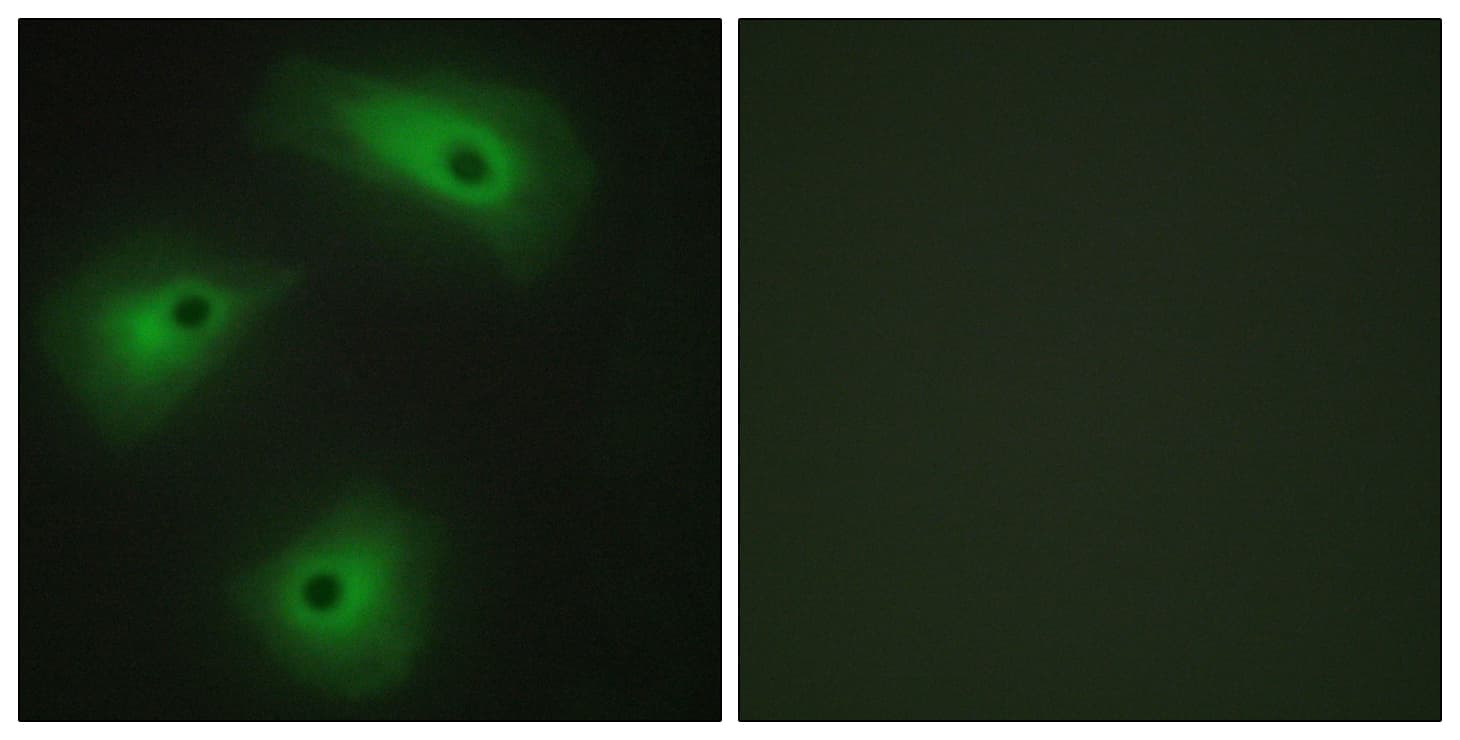 Polyclonal Rabbit anti-Human ANO1 / DOG1 / TMEM16A Antibody (aa921-970, IF)