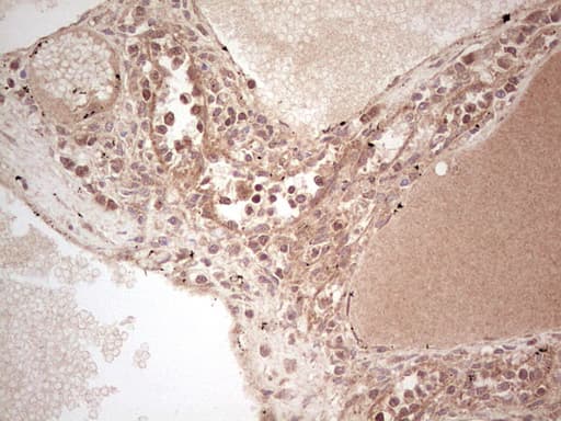 UBE2D2 / UBCH5B Antibody (clone OTI2C2)