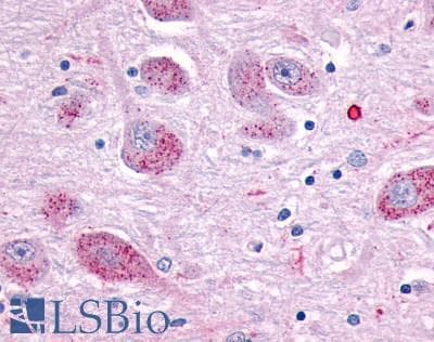 PathPlus™ Polyclonal Rabbit anti-Human CALCRL / CGRP Receptor Antibody (N-Terminus, IHC)