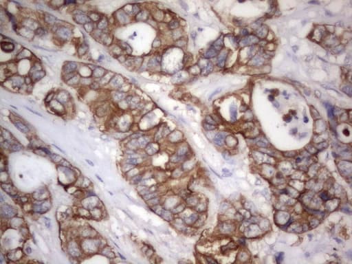 Acidic Cytokeratin Antibody (clone 7F10)