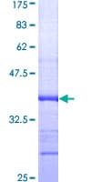 Human LSD / DNASE1L3 Protein (Recombinant GST, N-terminus)