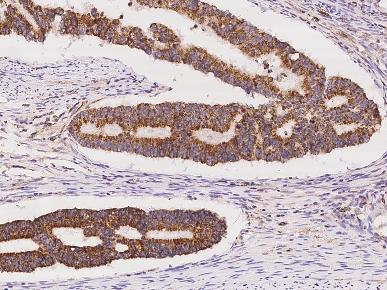 CD135 / FLT3 Antibody