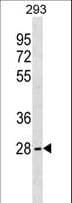 SRSF10 / FUSIP1 Antibody (aa197-225)