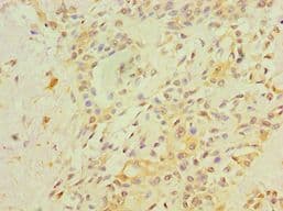 RB1 / Retinoblastoma / RB Antibody (aa649-928)