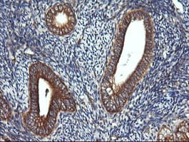 DNM1L / DRP1 Antibody (clone OTI4B5)