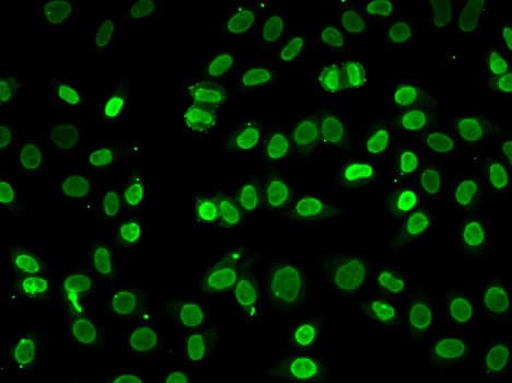 Polyclonal Rabbit anti-Human AKT1 Antibody (IHC, IF, WB)