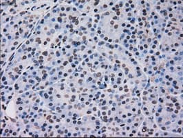 Monoclonal Mouse anti-Human MAPK12 / ERK6 / SAPK3 Antibody (clone OTI10E1, IHC, WB)