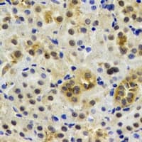 Polyclonal Rabbit anti-Human HUPF2 / UPF2 Antibody (IHC, WB)