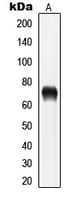 LIMK1 + LIMK2 Antibody (phospho-Thr508/Thr505)