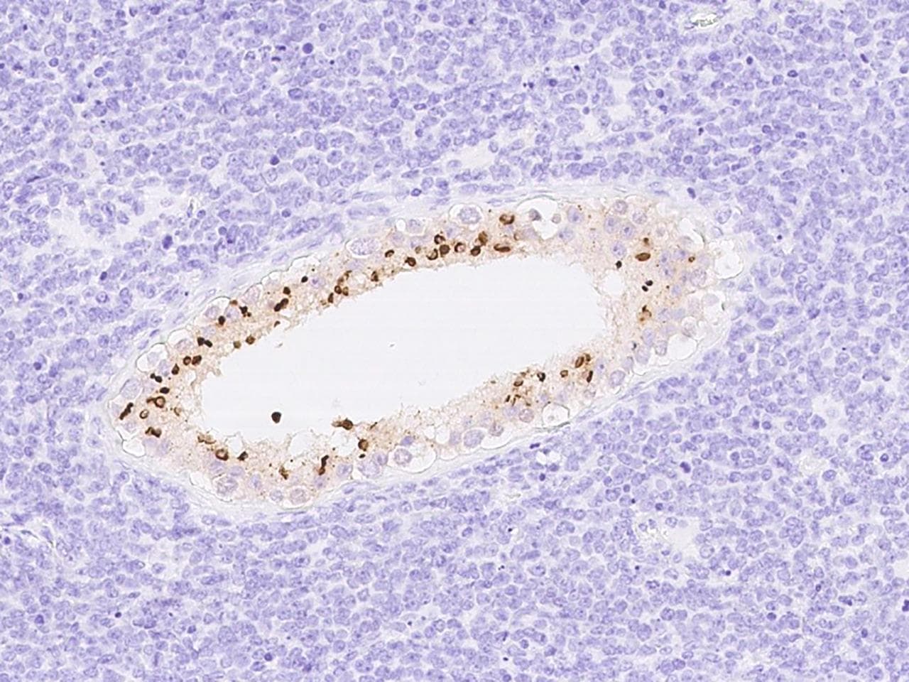 ACRV1/Intra-Acrosomal Protein Antibody (Preservative Free)