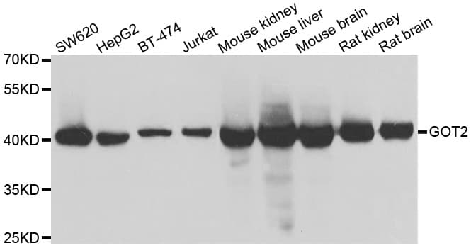 GOT2 Antibody
