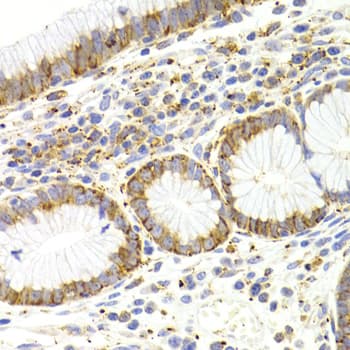 IHC-plus™ Polyclonal Rabbit anti-Human KISS1R / GPR54 Antibody (IHC, WB)