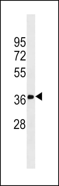 FN3K / Fructosamine-3-Kinase Antibody (clone 788CT24.5.1)