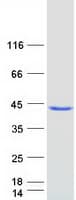 Human ARMC1 Protein (Recombinant Myc-DDK (Flag))