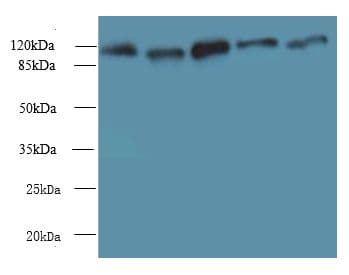 MORC2 Antibody