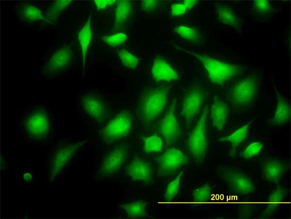IHC-plus™ Monoclonal Mouse anti-Human RAPGEF6 Antibody (clone 2C5, IHC, IF, WB)