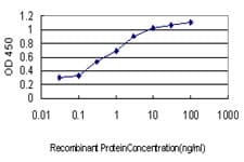 Monoclonal Mouse anti-Human MCHR1 Antibody (clone 3D7, WB)