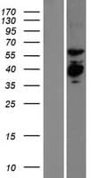 EXD2 Protein (Over-Expression Lysate Myc-DDK (Flag))
