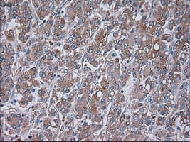 TRPM4 Antibody (clone OTI14C3)