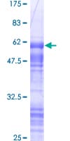 Human CRD / CRX Protein (Recombinant GST)