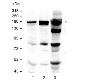 Polyclonal Rabbit anti-Human EGFR Antibody (WB)