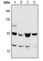 CTNNB1 / Beta Catenin Antibody