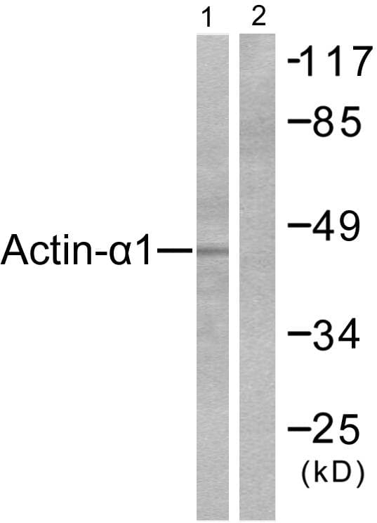 ACTA1 / Skeletal Muscle Actin Antibody