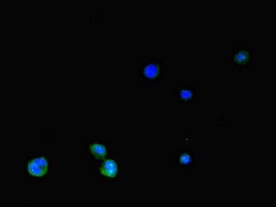 SLC2A3 / GLUT3 Antibody