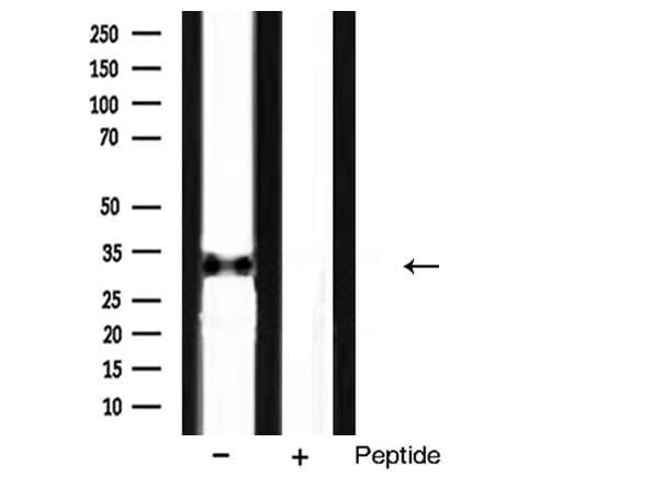 Polyclonal Rabbit anti-Human MYD88 Antibody (IHC, IF, WB)