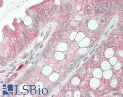 JAG1 / Jagged 1 Antibody (aa836-1047)