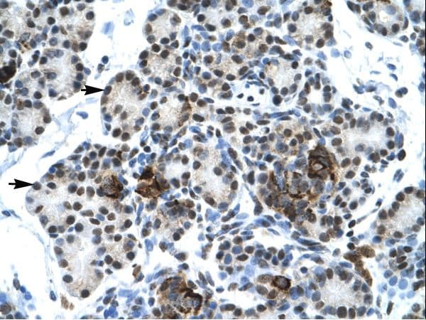 ETS1 / ETS-1 Antibody (aa52-101)