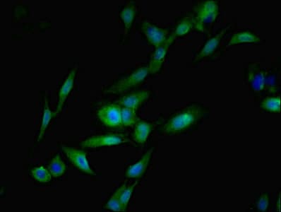 SGTA / SGT Antibody (aa1-120)