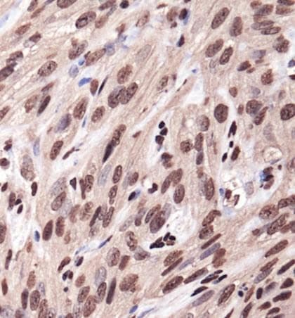IGF1R / IGF1 Receptor Antibody