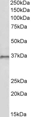 IHC-plus™ HOXC10 Antibody (aa175-188)
