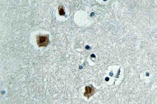 PAK3 Antibody (Asn148)