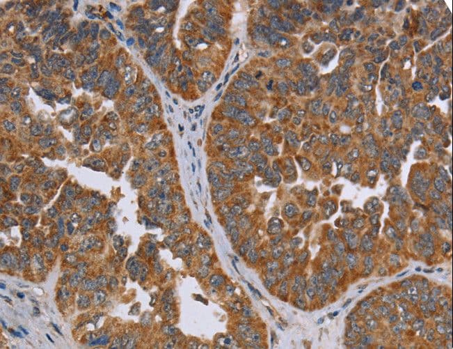 ADAMTS15 Antibody