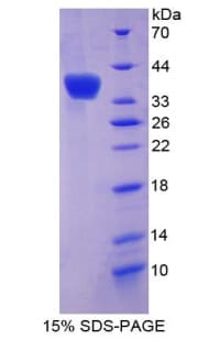 Mouse OLFM4 / Olfactomedin 4 Protein (Recombinant His-S)