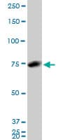 IHC-plus™ HNRPM / HNRNPM Antibody (clone 3F7)