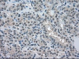 Monoclonal Mouse anti-Human LDHA / LDH1 Antibody (clone OTI2D11, IHC, WB)
