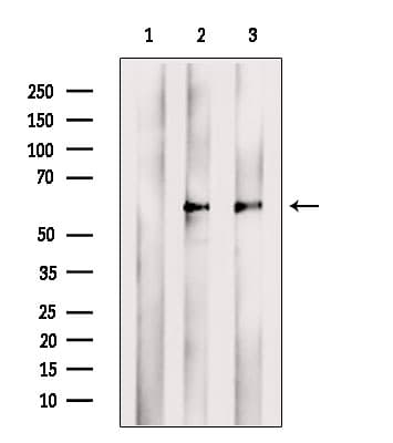 TCN2 Antibody