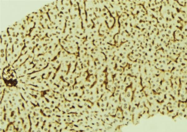 Polyclonal Rabbit anti-Human SATB2 Antibody (IHC, IF, WB)