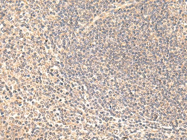 SULT4A1 / Sulfotransferase 4A1 Antibody