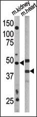 ATG4A Antibody (aa1-30)
